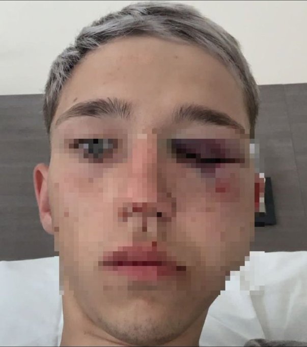 Móvil de LVDiez -Caso Bruno Borgna, golpeado por rugbiers en una fiesta en Lujan en 2021